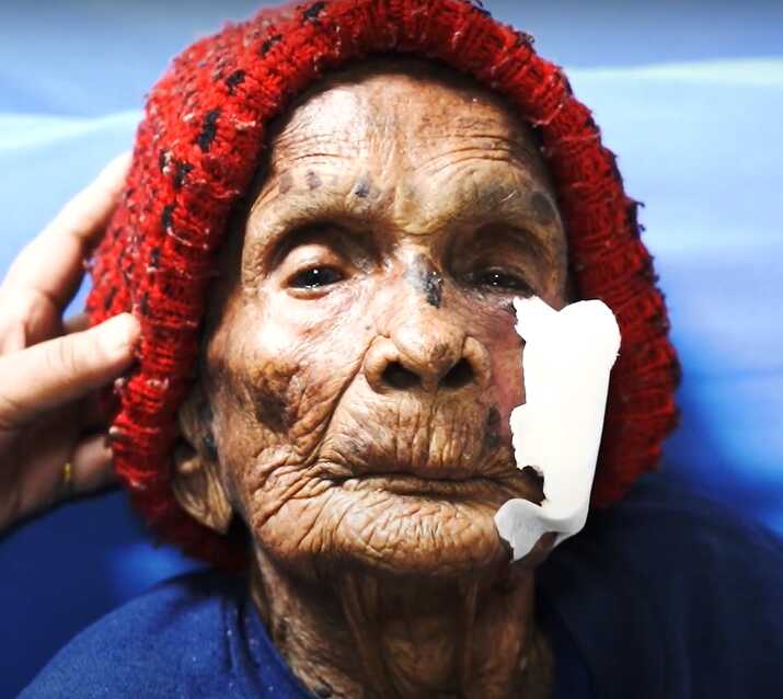 patient image